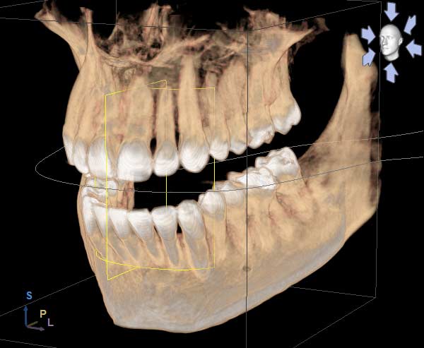 3D imaging