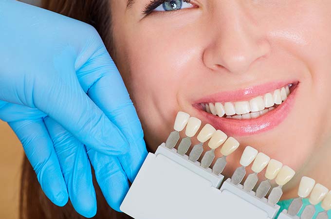 Close upofagirlwithabeautifulsmileatthedentist.Dentalcareconcept.Setofimplantswithvariousshadesoftone