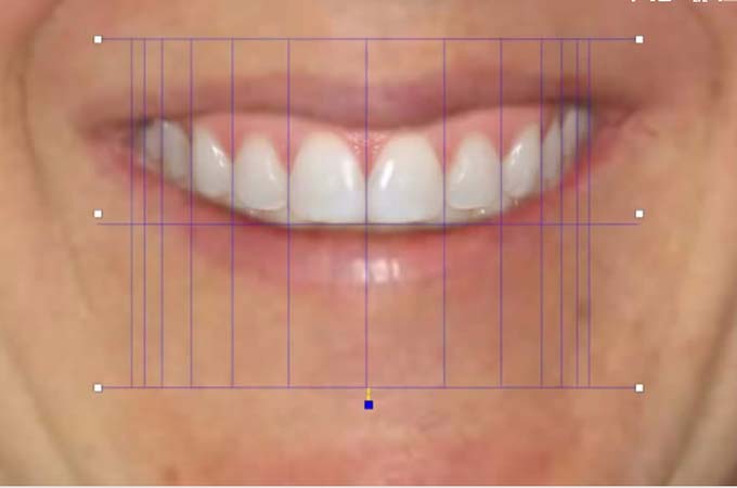 promotion smile simulation