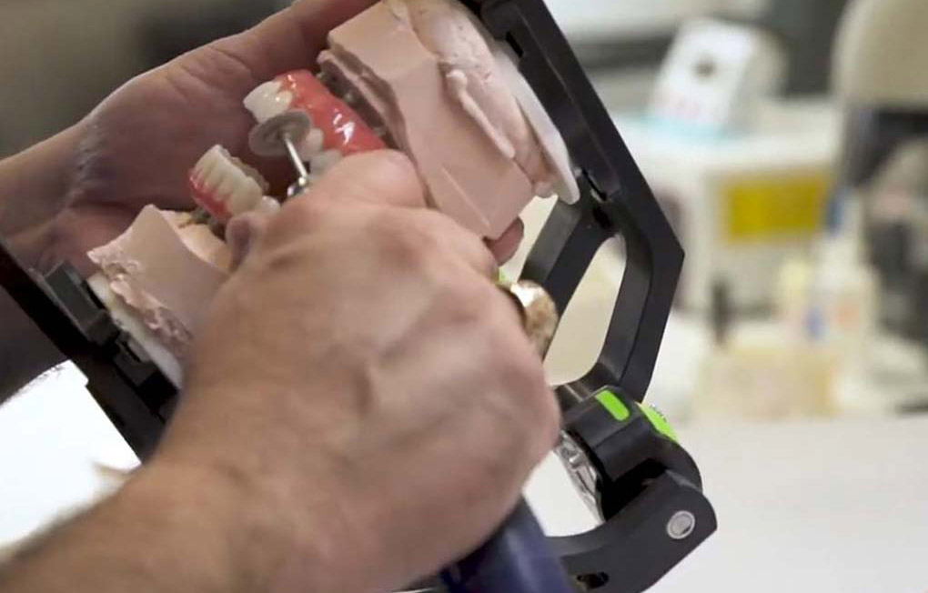 technology crafting implants