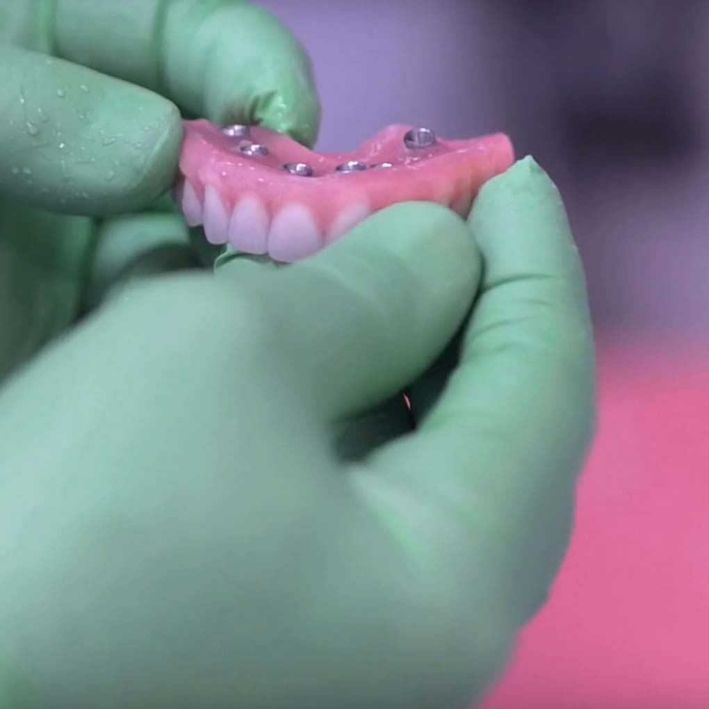 technology holding implants 9